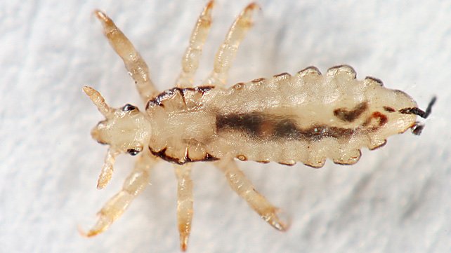 Can lice go in your brain?